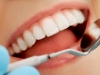 Các dấu hiệu cho thấy răng bạn có nguy cơ bị sâu răng?
